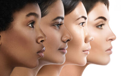 Skin type